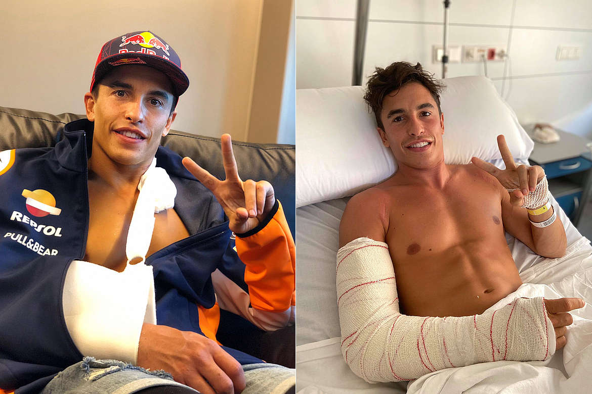 Marc Marquez operato