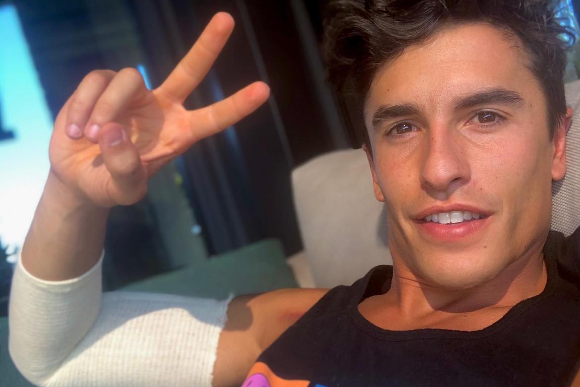 Marc Marquez braccio